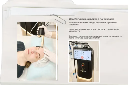 Мы протестировали популярные аппаратные процедуры — и вот наши выводы