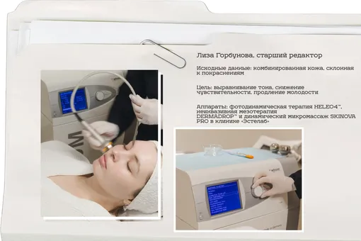Мы протестировали популярные аппаратные процедуры — и вот наши выводы